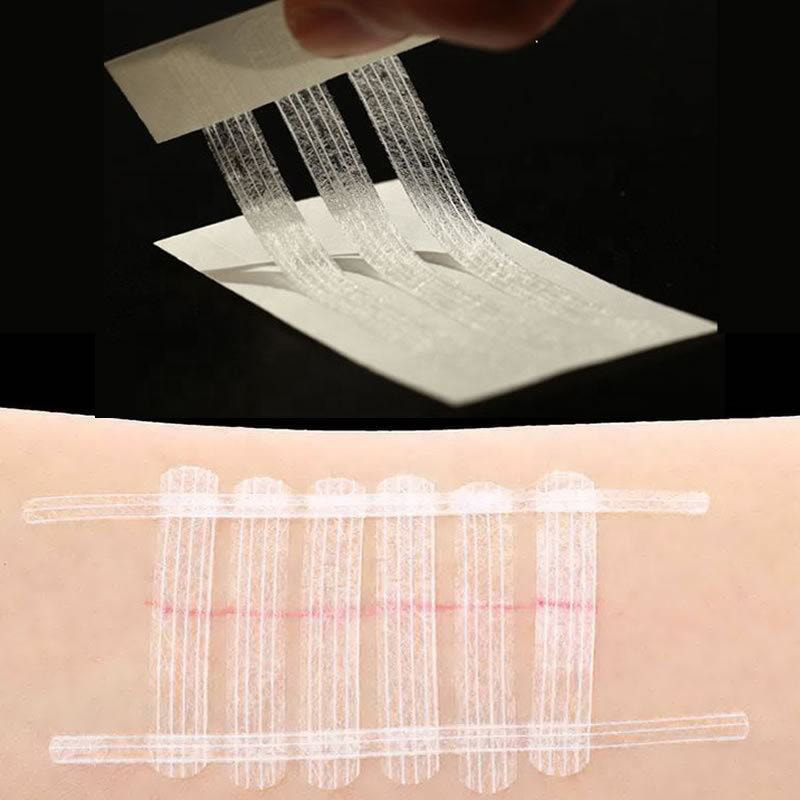 Bande adhésive stérile jetable de fermeture de plaie cutanée